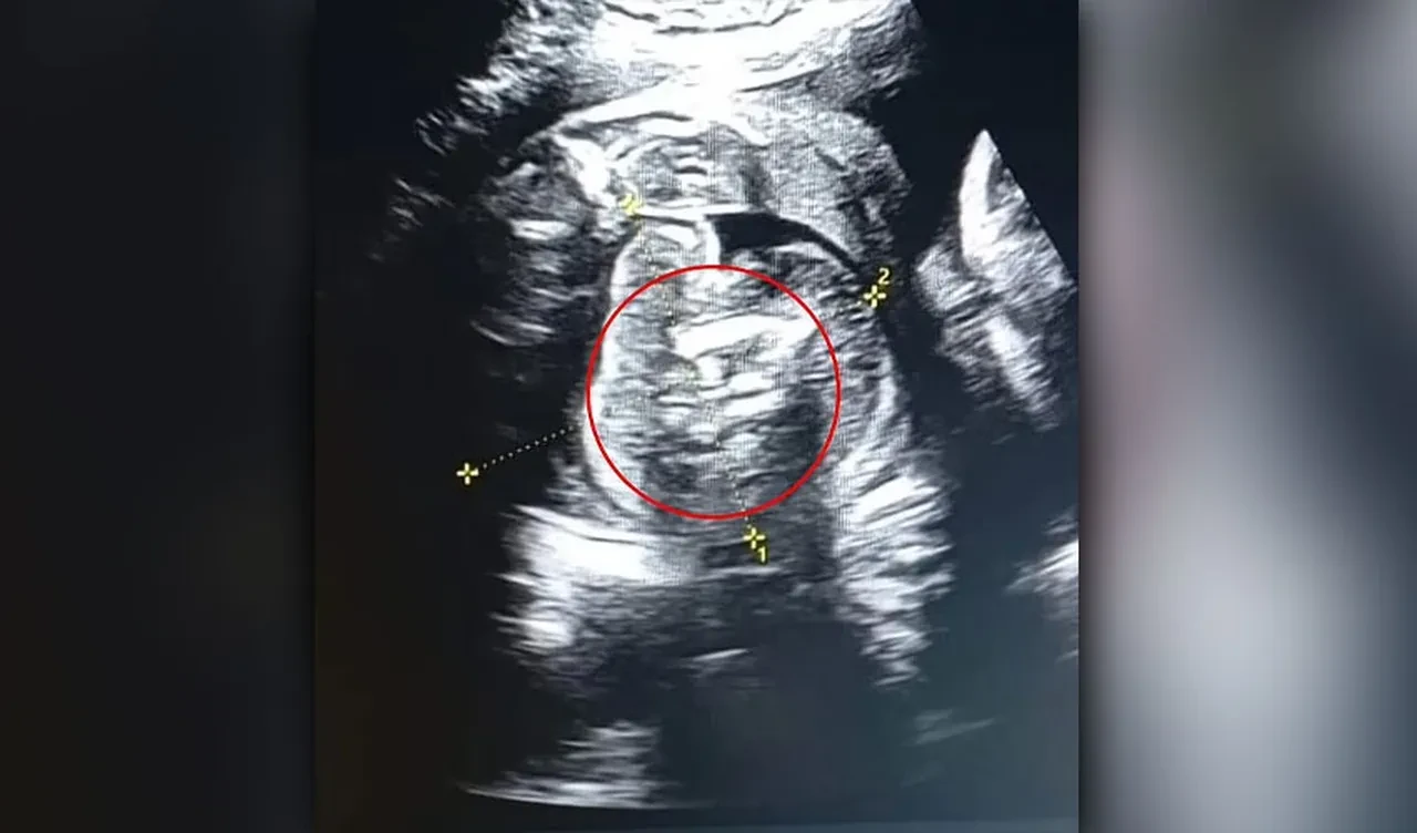 Doğmamış bebeğin midesinde tespit edildi! Doktorlar bile şoke oldu