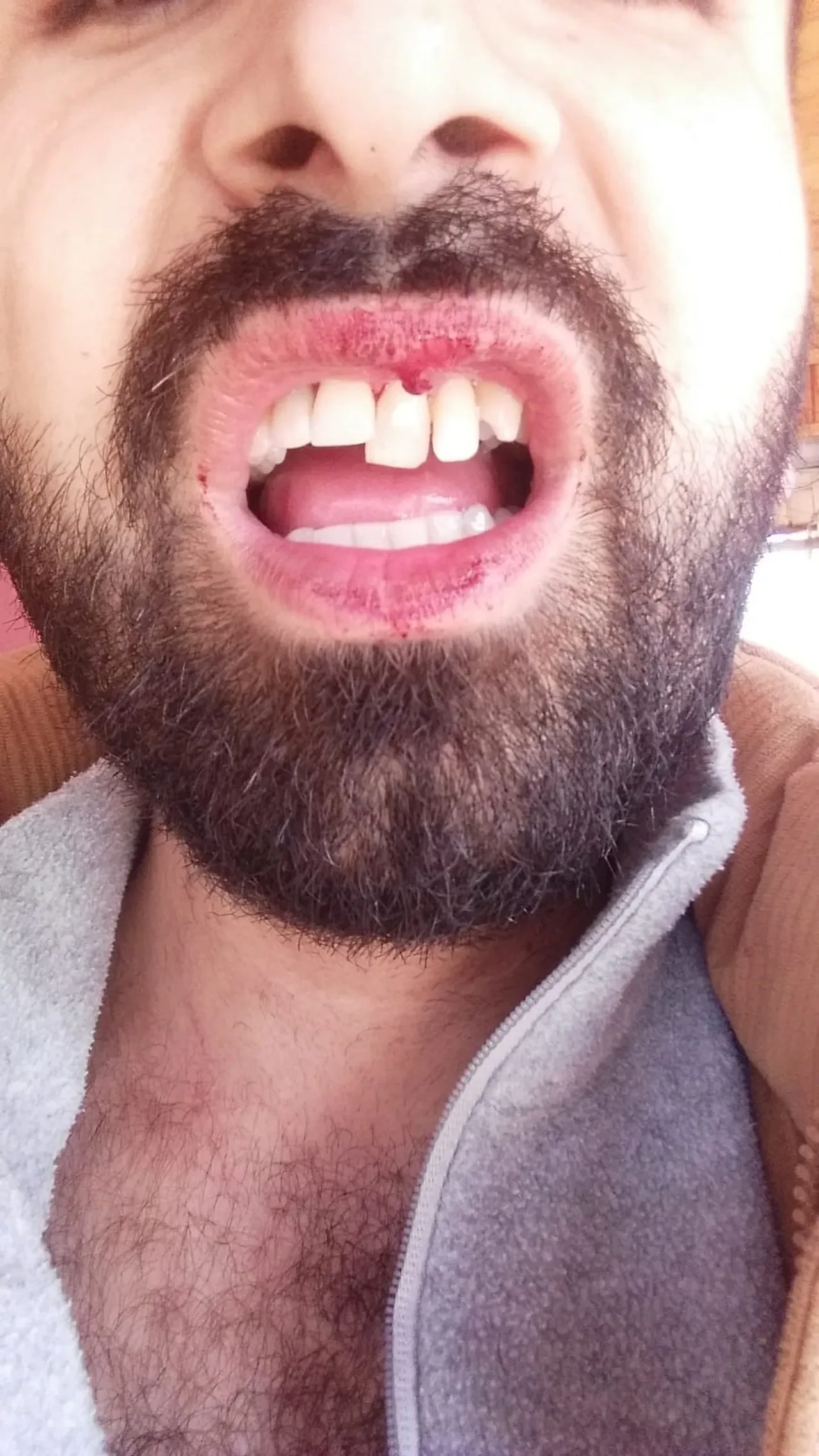 Tahsilat için gittiği pilavcıda hayatının şokunu yaşadı! Kapıyı açık unutan adama öldüresiye dayak