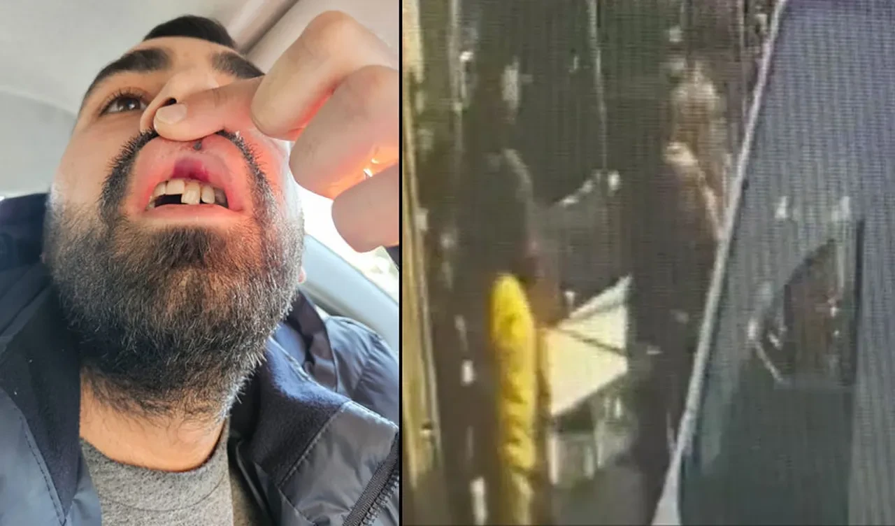 Tahsilat için gittiği pilavcıda hayatının şokunu yaşadı! Kapıyı açık unutan adama öldüresiye dayak