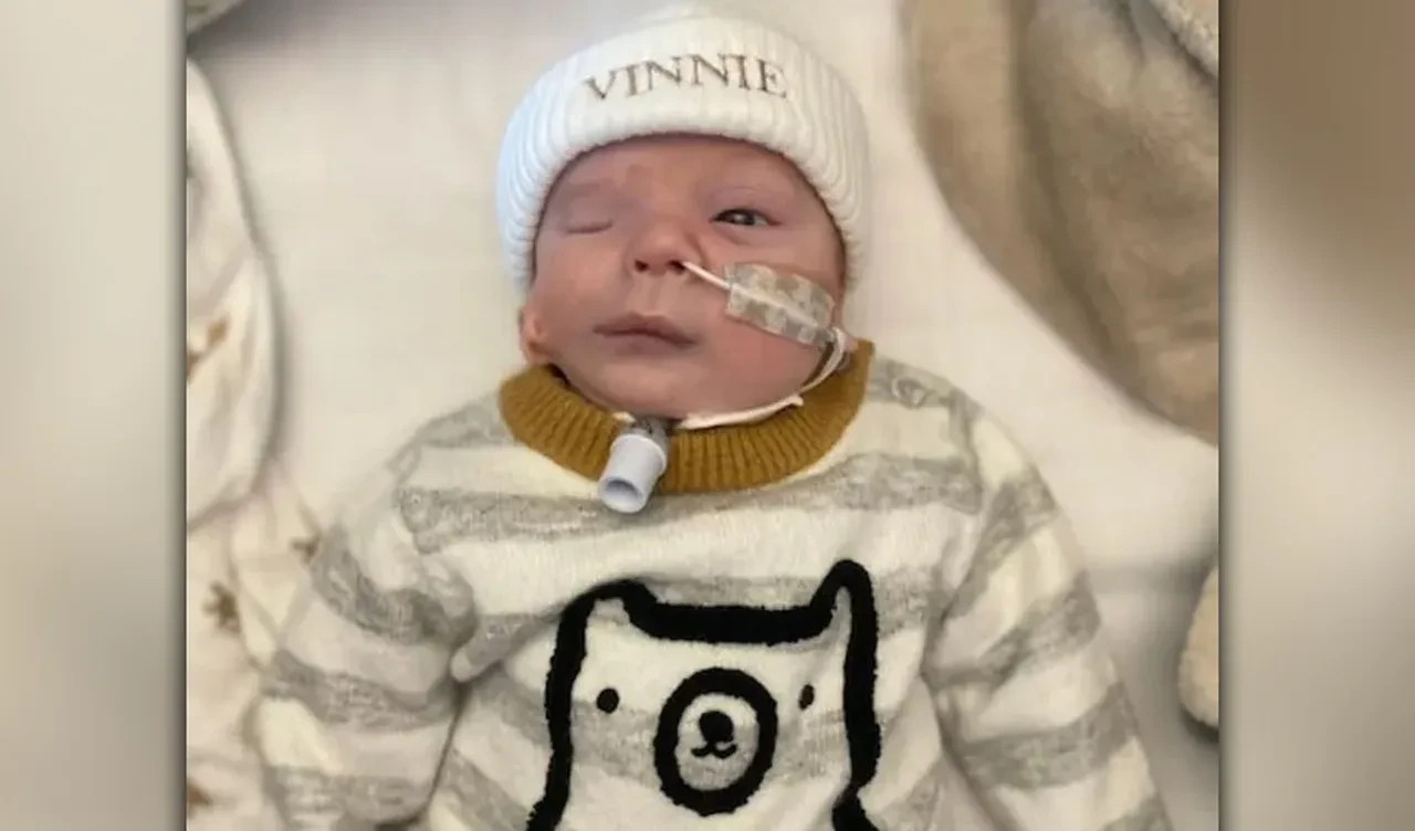 Yanağında kulakla doğan bebek! Doktorlar sebebini açıkladı