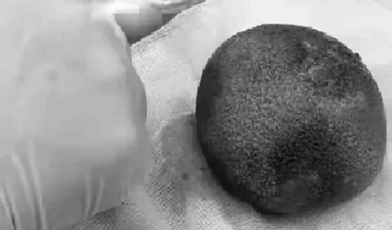 Mide ağrısı şikayetiyle hastaneye gitti! Doktorlar gözlerine inanamadı