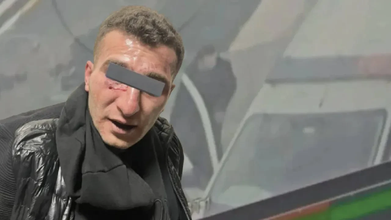 İstanbul'da polislere bıçakla saldırmıştı! Skandal savunma ortaya çıktı 