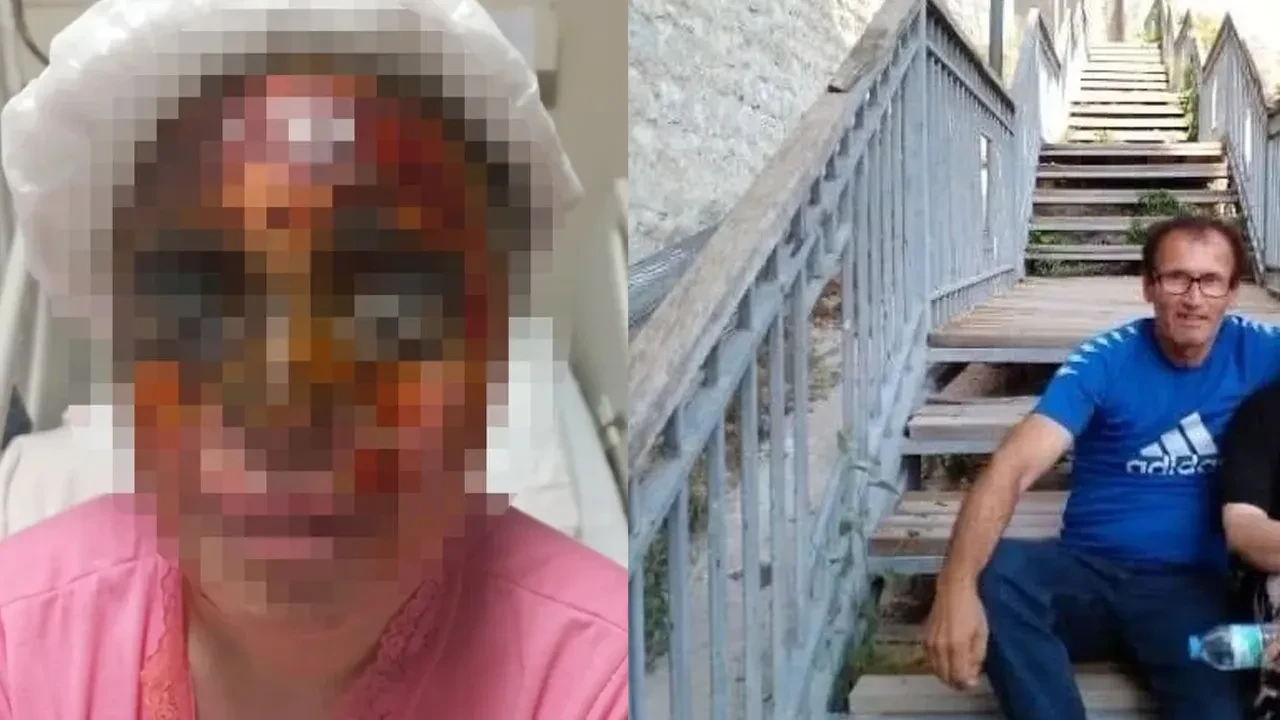 İstanbul'da dehşet anları kamerada! Kendisini reddeden kadının yüzüne kezzap döküp kör bıraktı