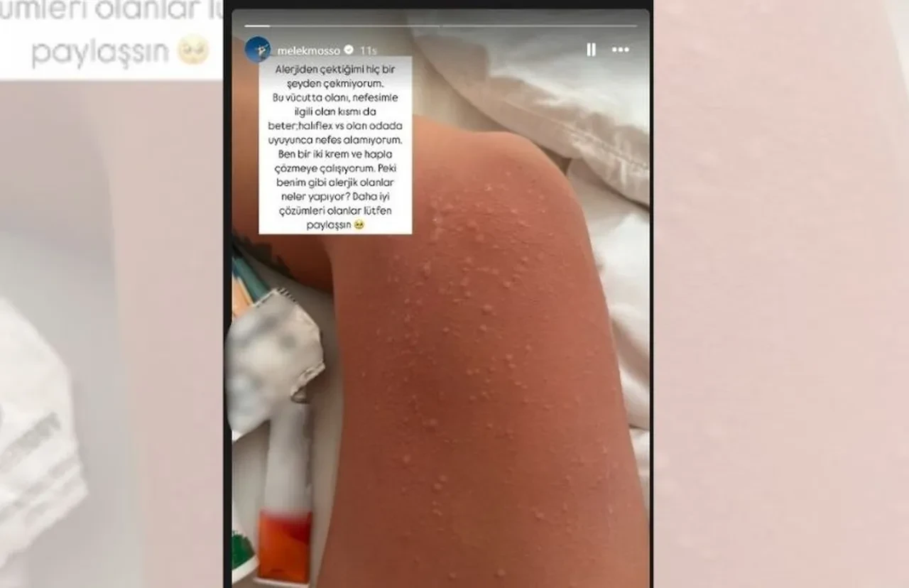 Melek Mosso hastanelik oldu! Paylaştığı fotoğraf endişelendirdi: Nefes alamıyorum