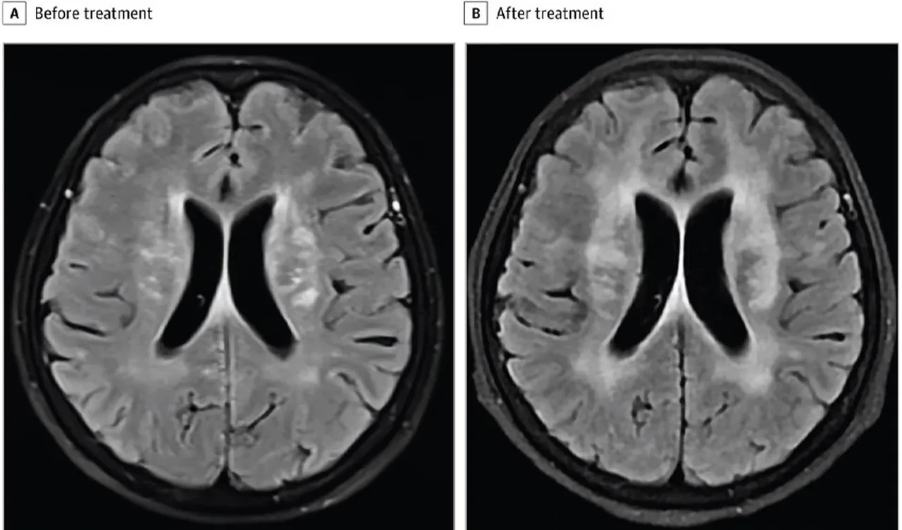 Mutfaktaki ufak bir dikkatsizlik ölümden döndürdü! Beyninin her yerini sarmıştı