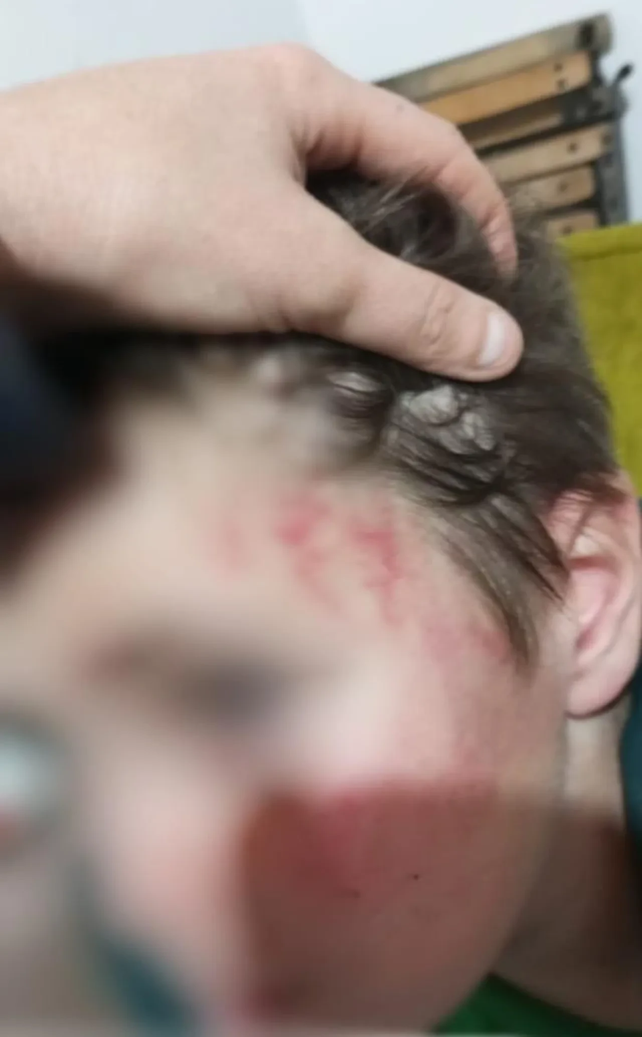 Otizmli çocuğunu darp etti! Cani babaya hapis cezası