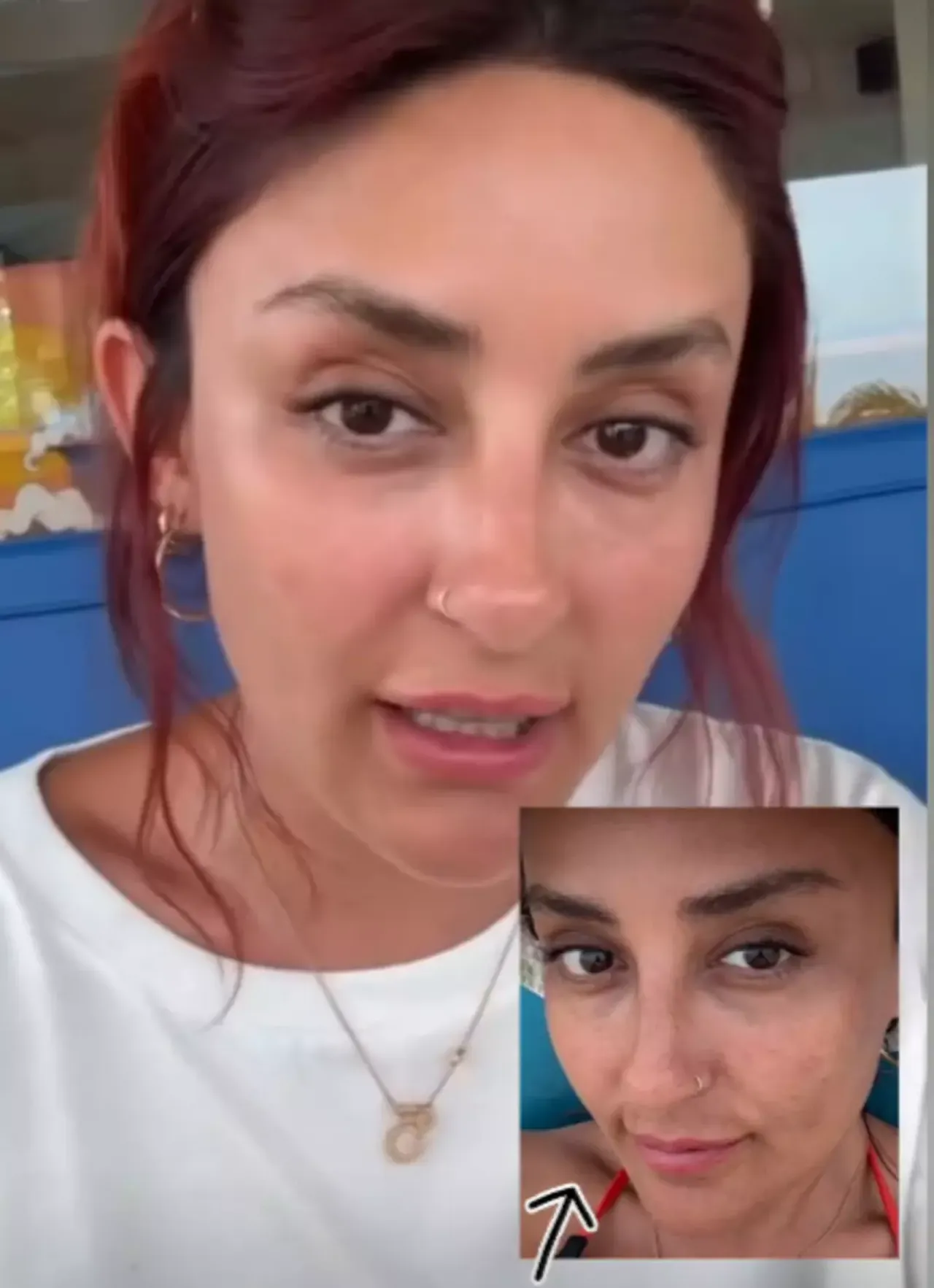Melek Mosso’nun yüzünü görenler şaşırdı, DM kutusu doldu! Makyajsız hali gündemde