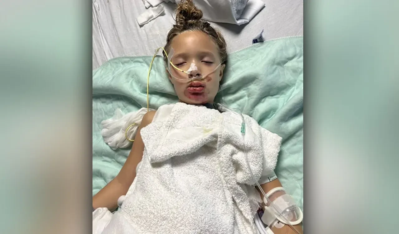 TikTok akımı küçük kızı önce yaktı sonra komaya soktu! Ebeveynlere uyarı gecikmedi