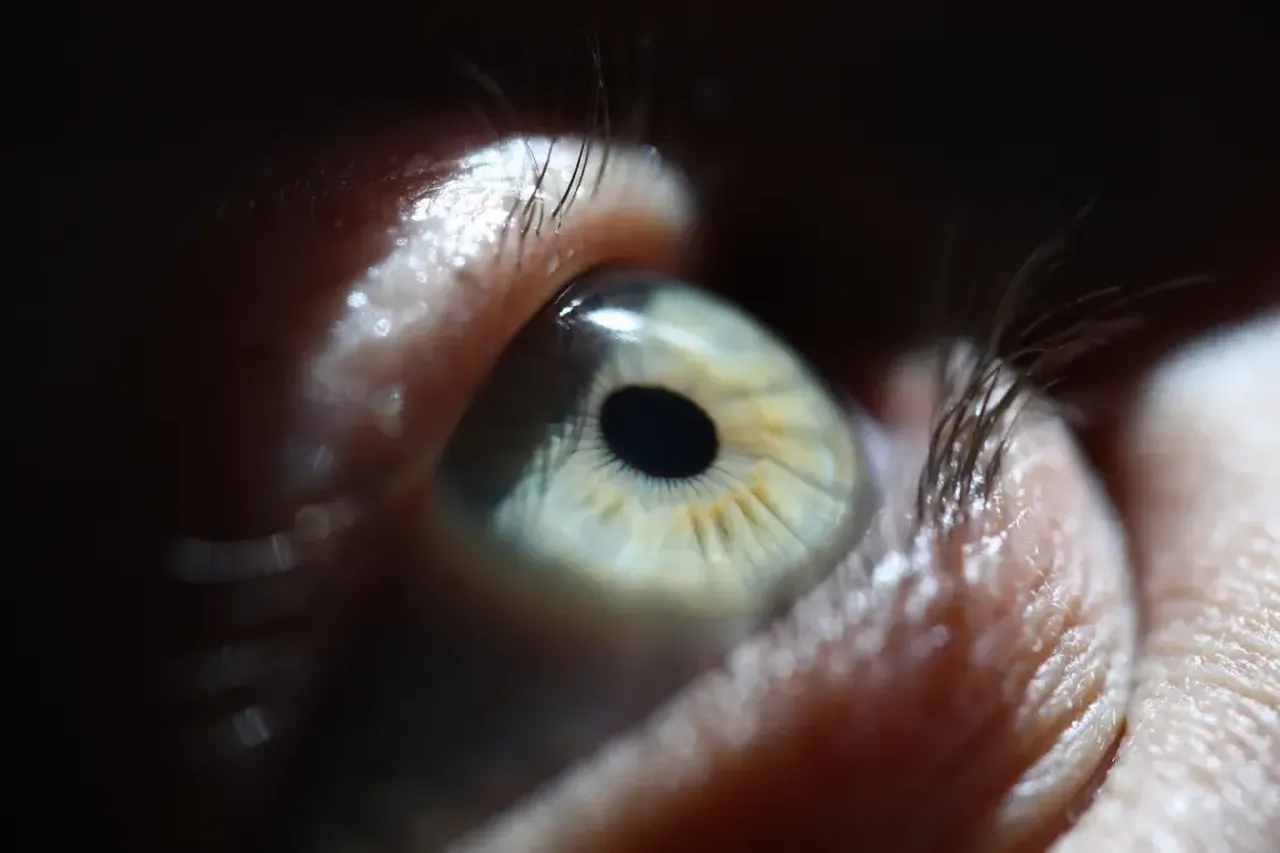 Dişine mercek yerleştirildi görme yetisini geri kazanacak!