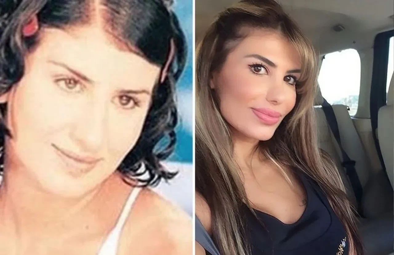 Şarkıcı Hatice botoks zehirlenmesi yaşadı! Son halini sosyal medyadan paylaştı 