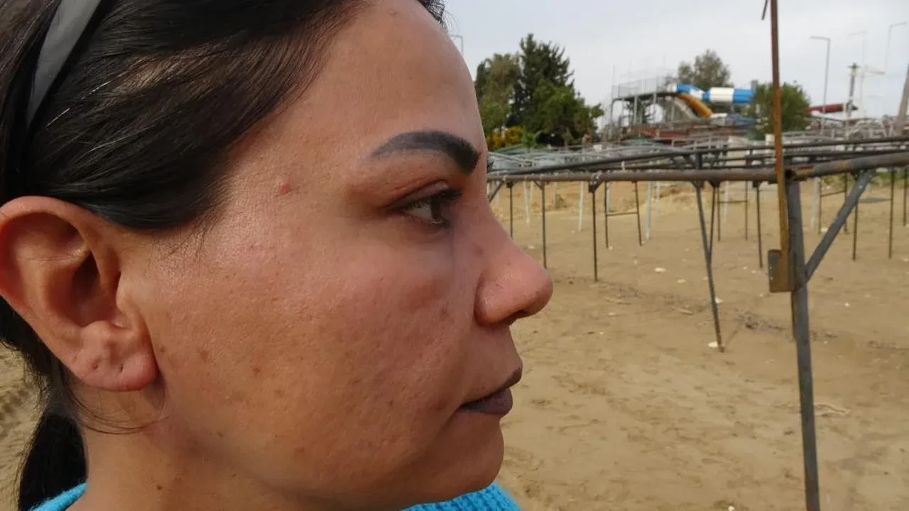 Estetiğe 200 bin TL harcadı, hayatı kabusa döndü