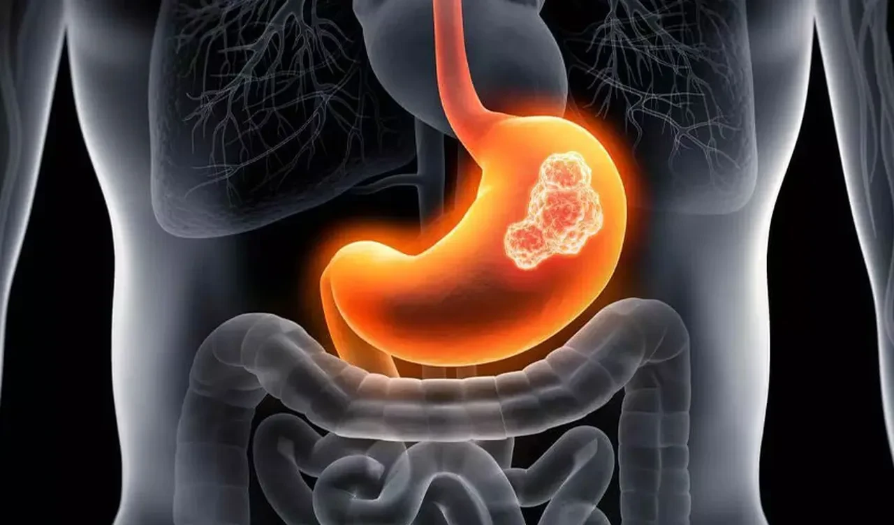 İki yıl boyunca sürekli hıçkırdı! Nedeni hastanede ortaya çıktı