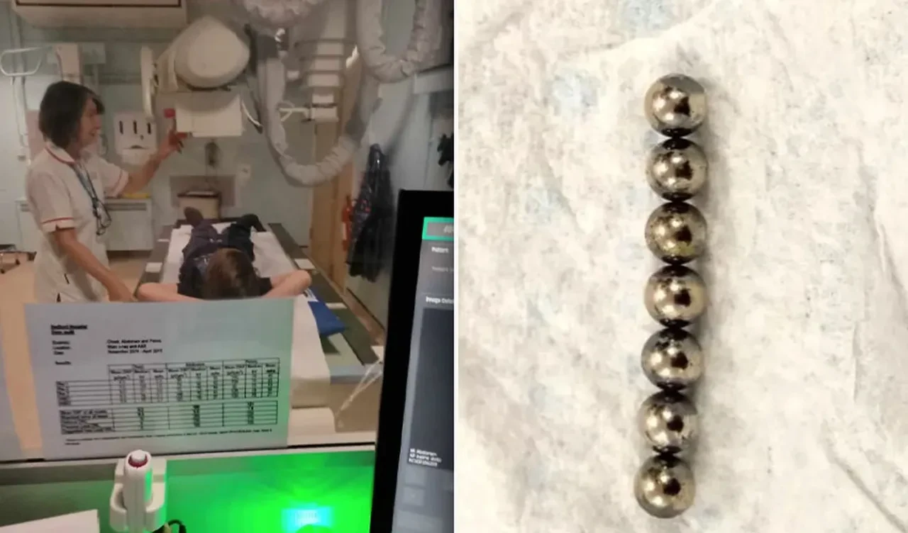 TikTok akımı yine bir çocuğu ipe götürdü! Trend olan manyetik toplar az kalsın öldürüyordu