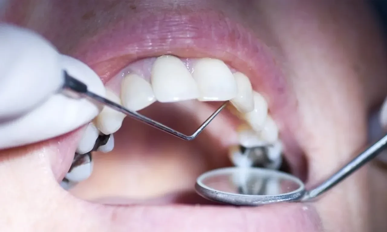 Ramazanda neredeyse herkes kullanıyor! Uzmanından kritik uyarı: "Alkollü gargaraya yaklaşmayın!"