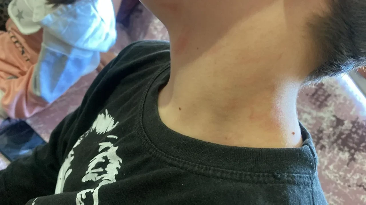 Öğrenciye şiddet! 'Kızlar konuşunca ne olacak?' diye sordu darp edildi