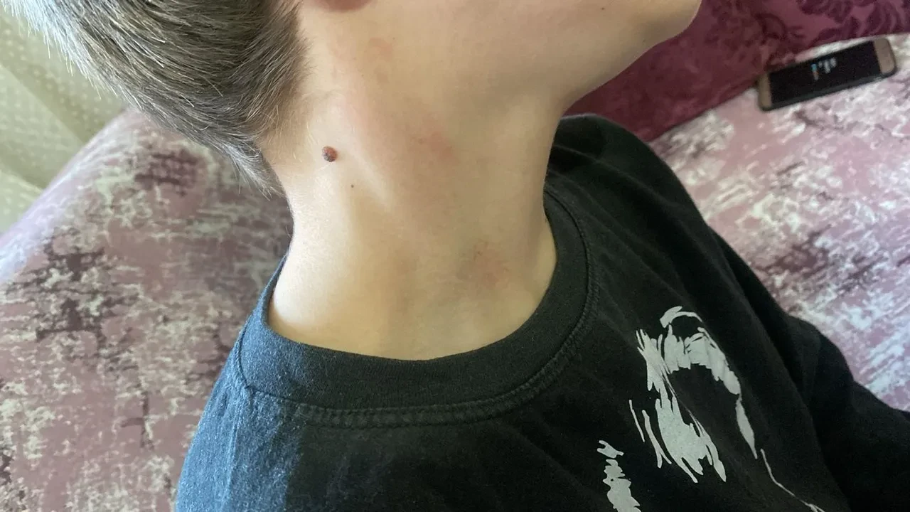 Öğrenciye şiddet! 'Kızlar konuşunca ne olacak?' diye sordu darp edildi