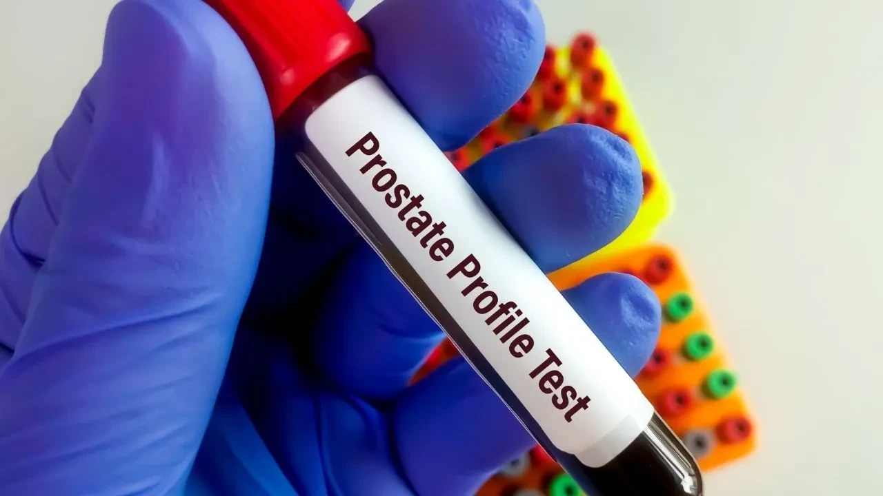 Prostat kanserinin tespitinde devrim! Tükürük testi ile riski öğrenebilirsiniz