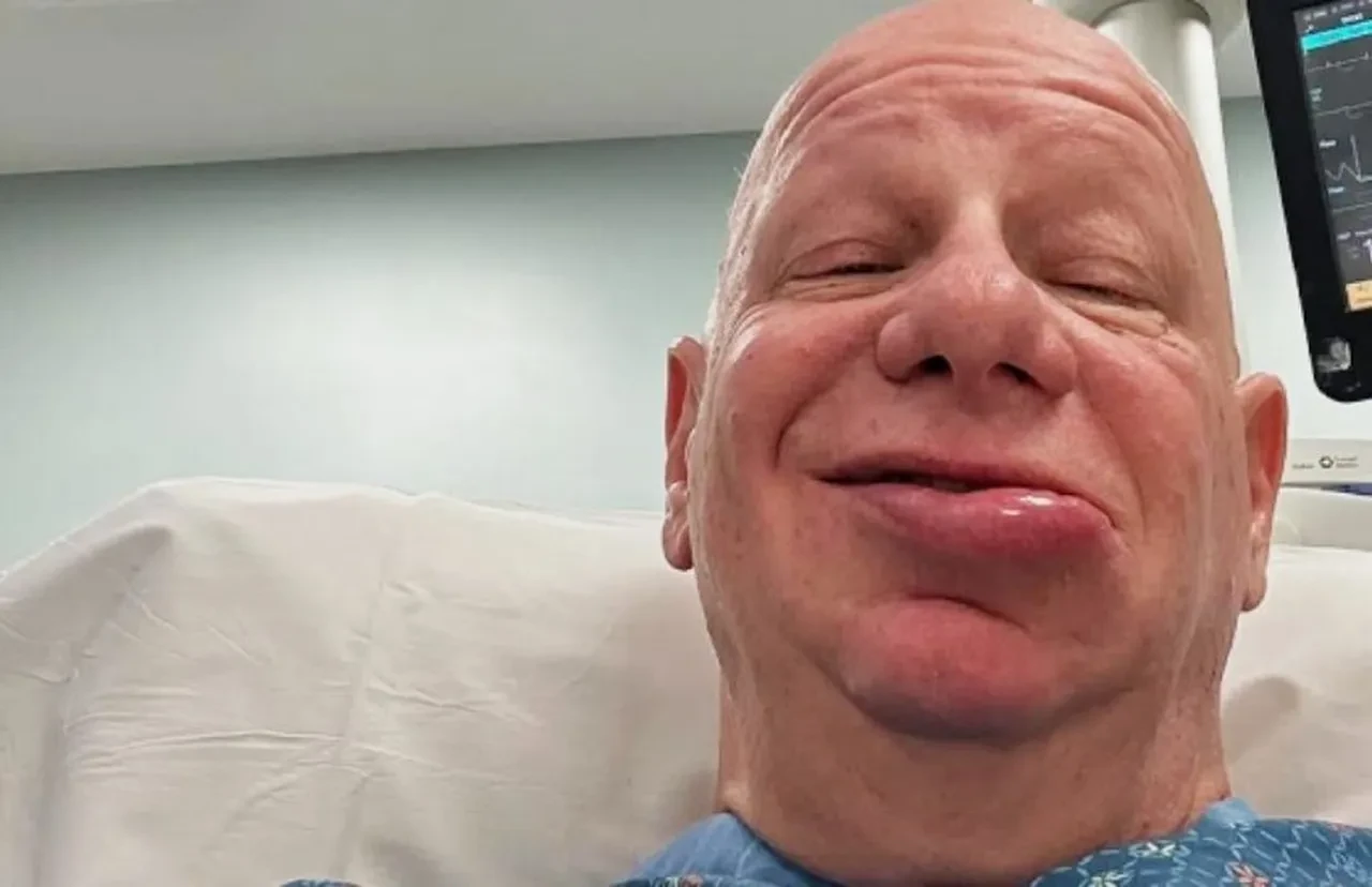 Ünlü komedyen Jeff Ross, dondurma yüzünden hastanelik oldu! Son hali sevenlerini korkuttu