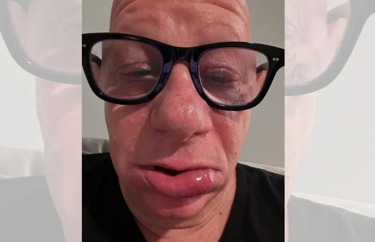 Ünlü komedyen Jeff Ross, dondurma yüzünden hastanelik oldu! Son hali sevenlerini korkuttu