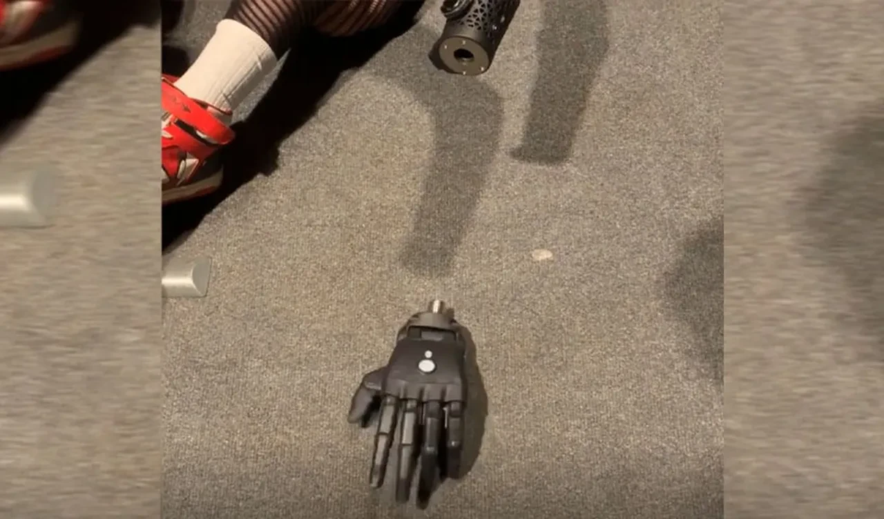 Bilim kurgu değil gerçek! Dünyanın en gelişmiş biyonik eli: Koldan ayrıldığında bile hareket edebiliyor