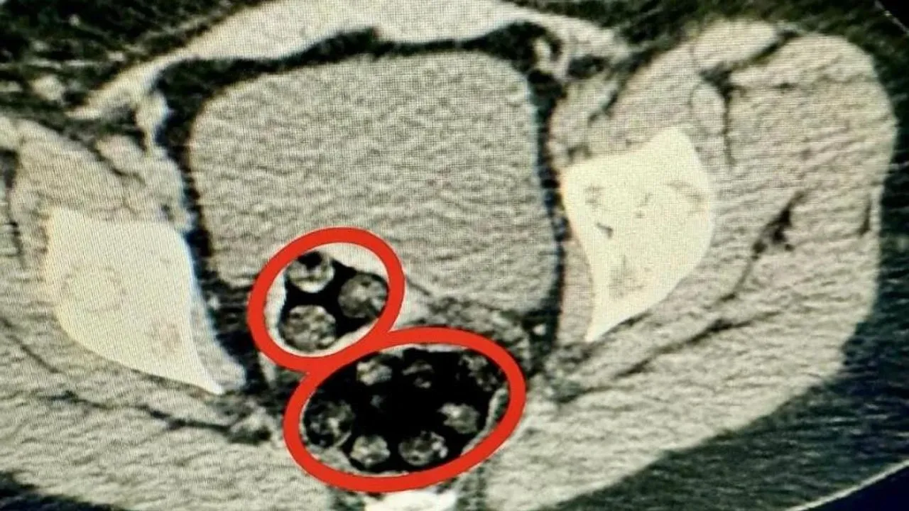 İranlı uyuşturucu satıcısı kıskıvrak yakalandı! Yasaklı maddeleri sakladığı yer yok artık dedirtti