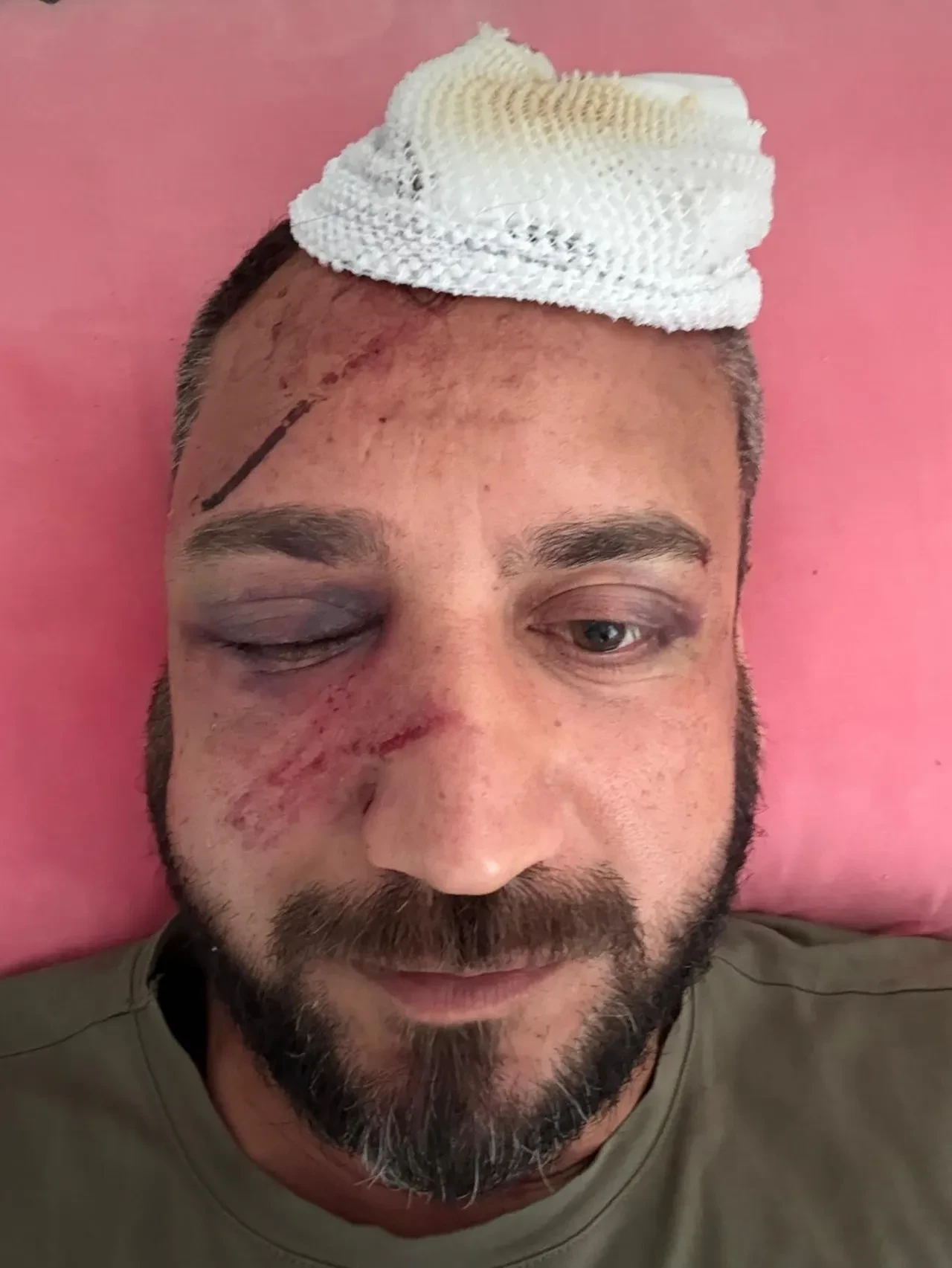 Sevgilisine verdiği parayı geri isteyince dehşeti yaşadı! Sokak ortasında öldüresiye dayak