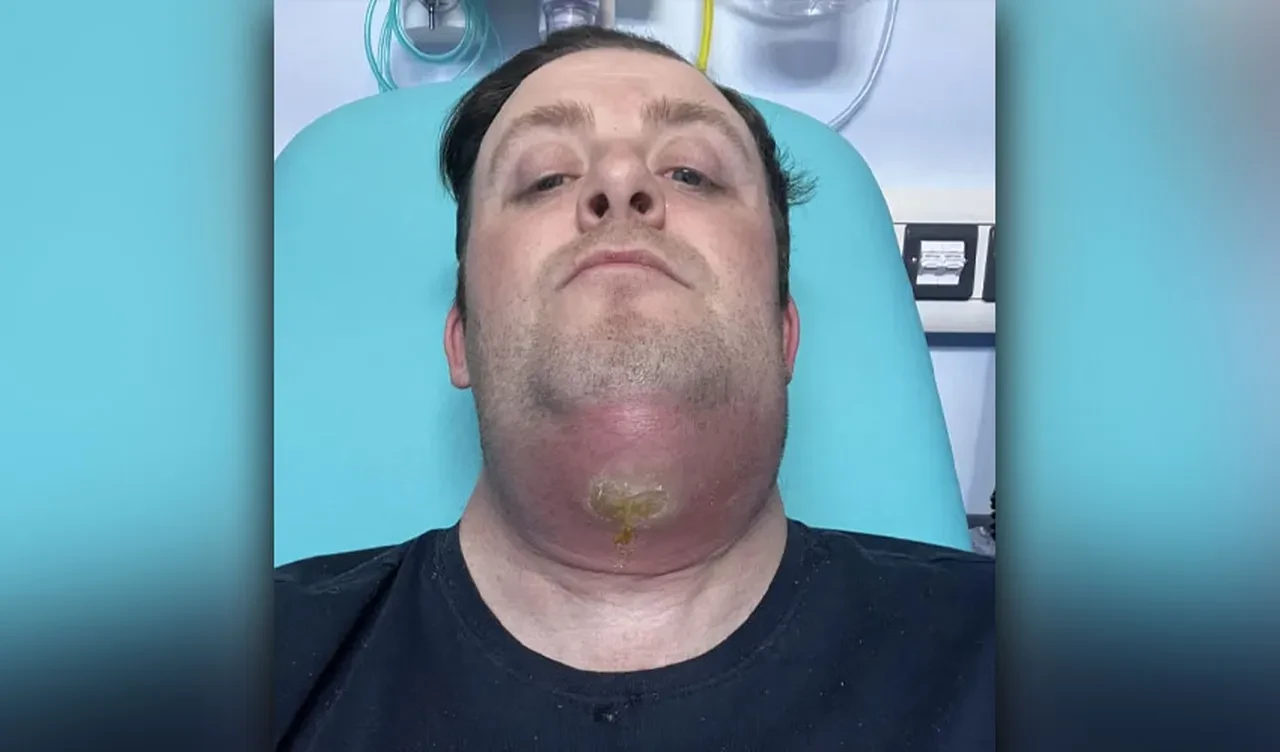 'Basit bir diş ağrısı' ölüme çok yaklaştırdı! Artık herkesi uyarıyor