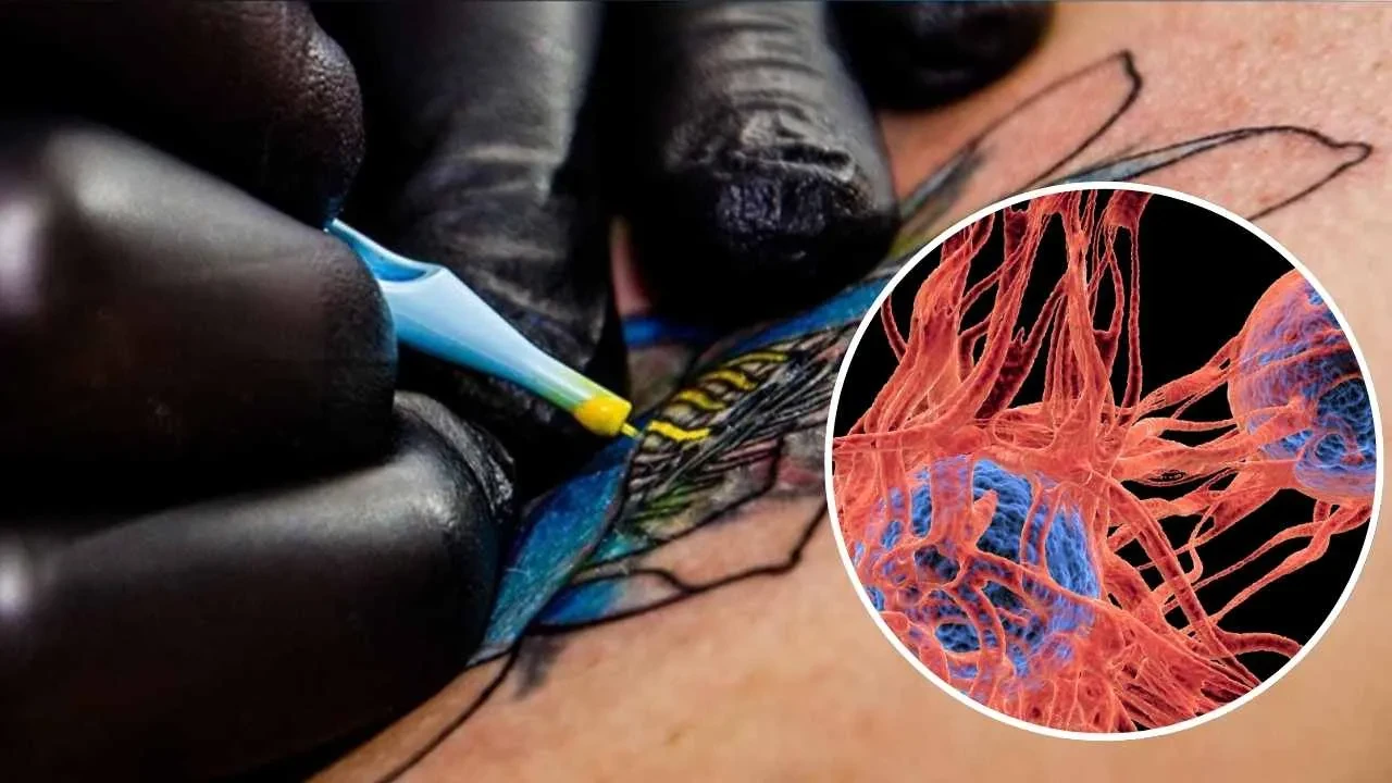 Dövme yaptırdı, hayatı kabusa döndü! Zehirli bir uzak: Bacağını kaybediyordu