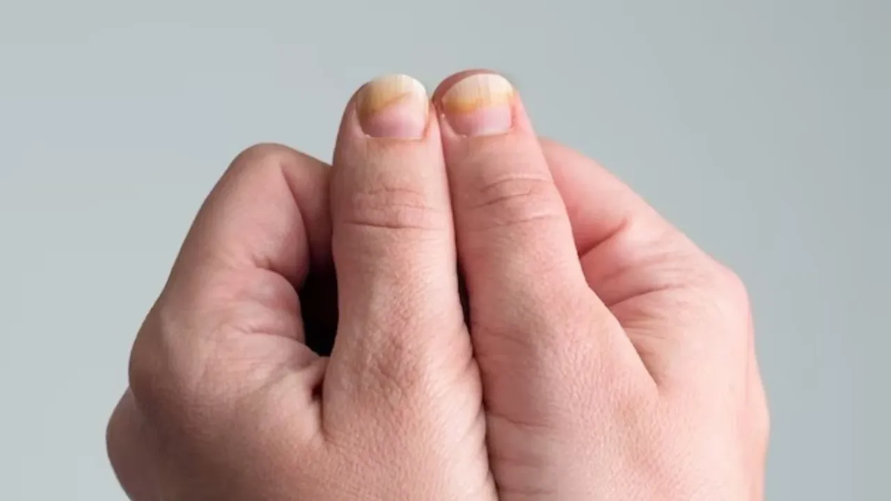 Tırnaklar kanser riskinin habercisi olabilir mi?