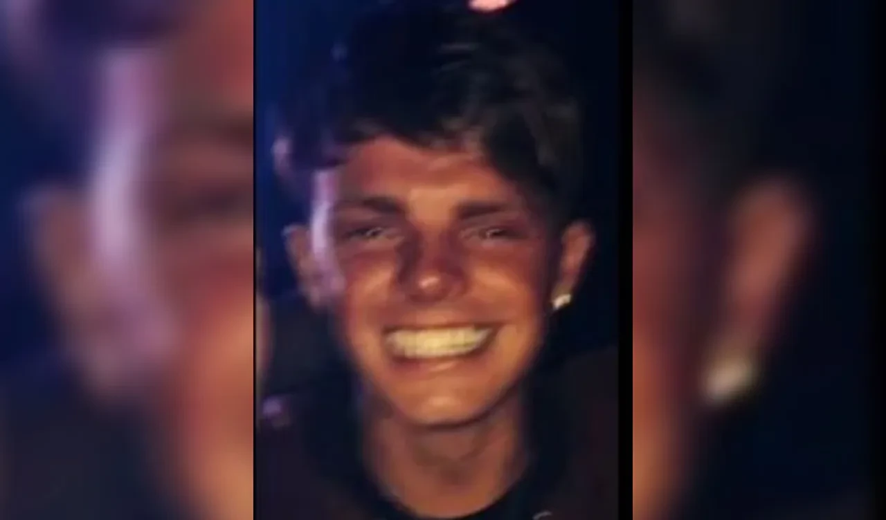 Türkiye'de saç ektirmek için orduyu dolandırdı! Ülke bu skandalla çalkalanıyor