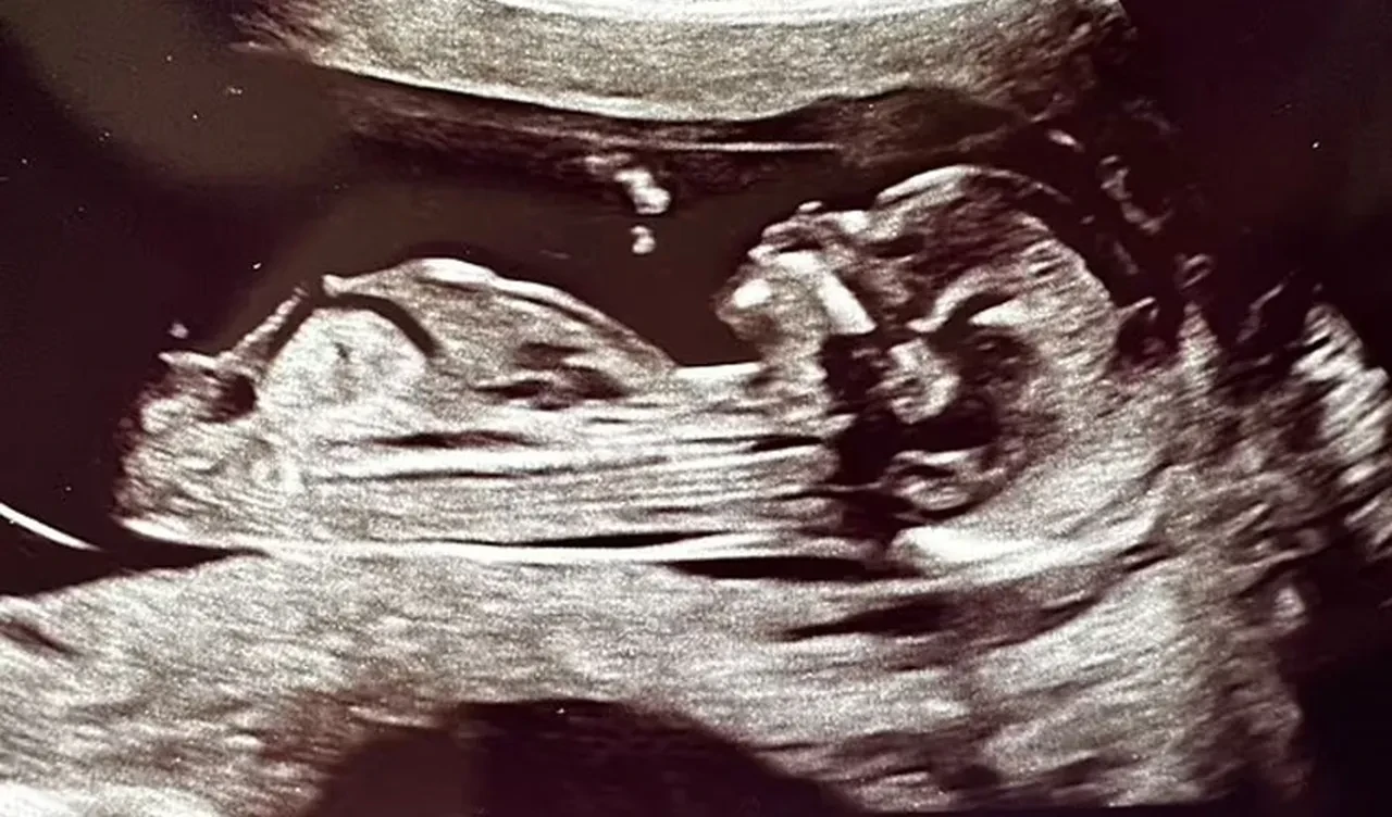 İki kez doğan bebek tıp literatürüne girdi! Zorlu süreçlerin ardından gelen mutluluk