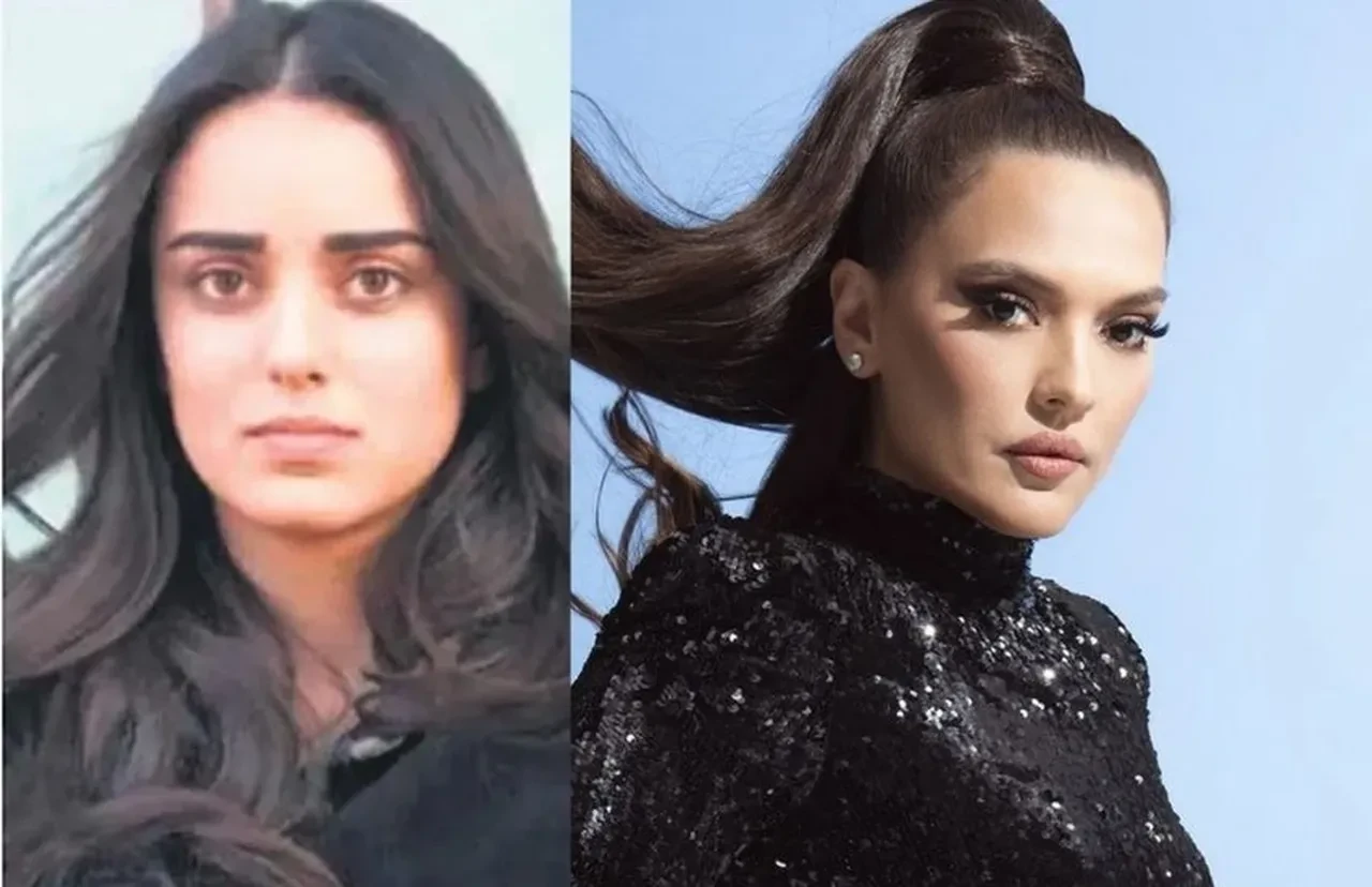 Demet Akalın, Bestemsu Özdemir'i diline doladı! Estetik kavgası büyüyor
