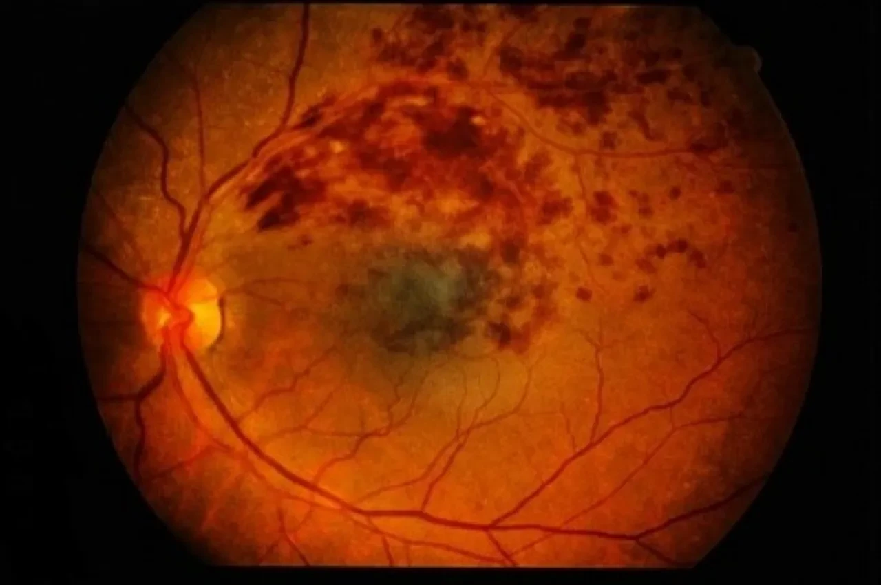 Gözlerinize bakarak alzheimer riskini tespit edebilecekler