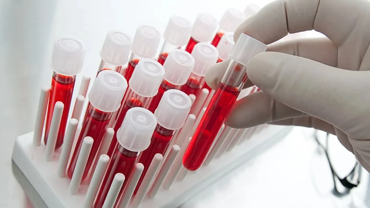 Kan grubunu öğrenme: Kan grubu nasıl öğrenilir ve nereden bakılır?