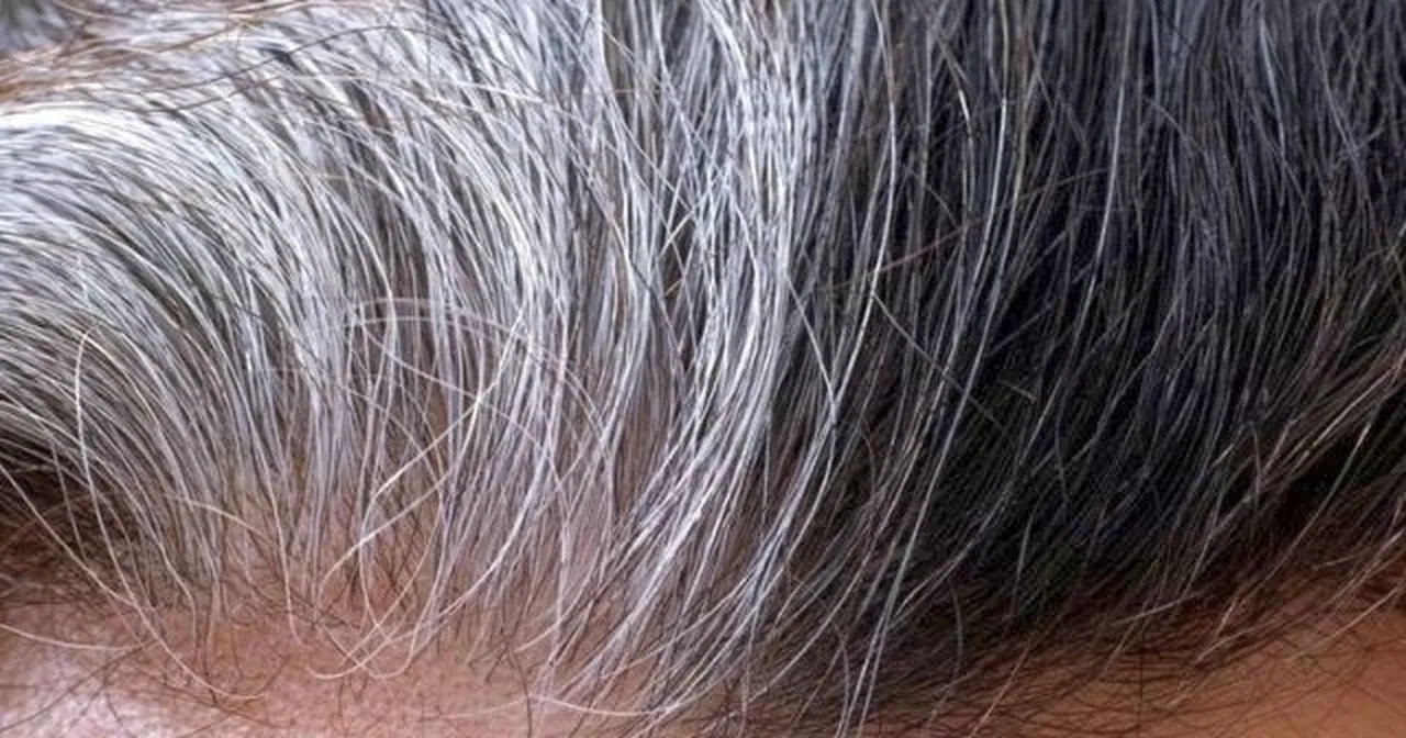 Saçların erken beyazlamasını önlemek düşündüğünüzden daha basit! 4 adımda beyaz saçlara veda edin