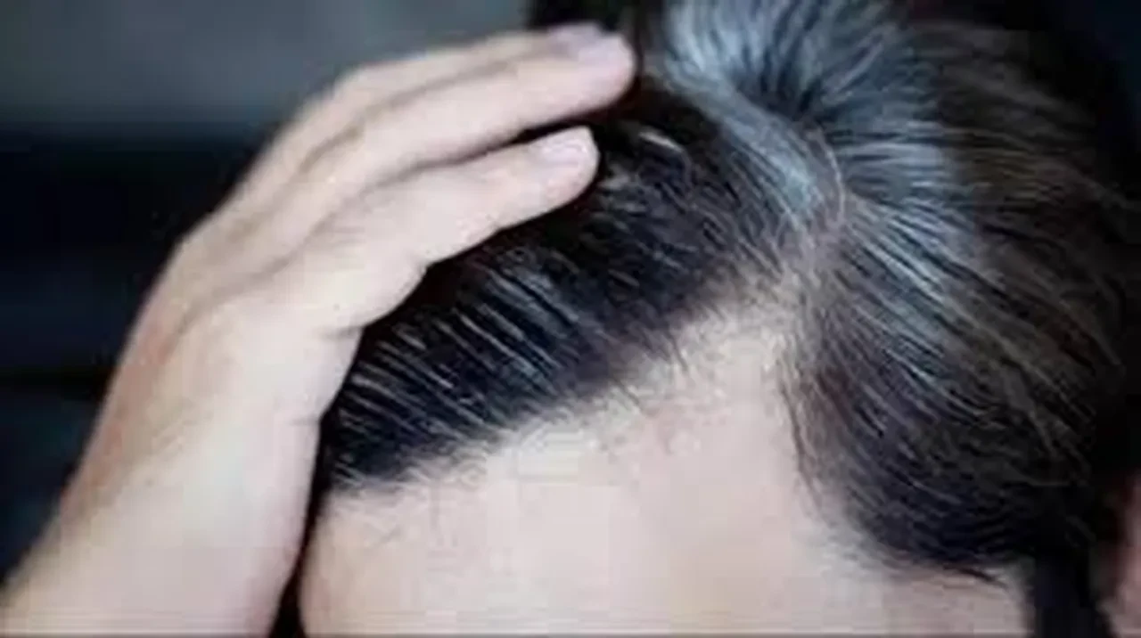 Saçların erken beyazlamasını önlemek düşündüğünüzden daha basit! 4 adımda beyaz saçlara veda edin