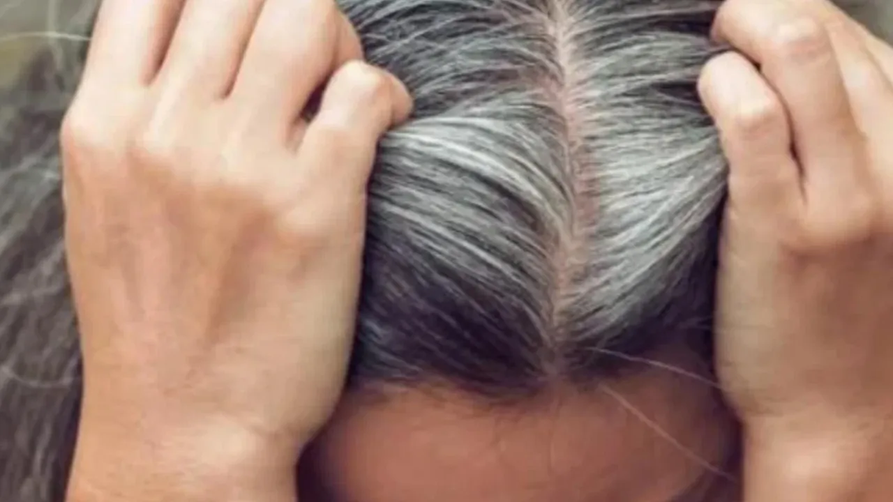 Saçların erken beyazlamasını önlemek düşündüğünüzden daha basit! 4 adımda beyaz saçlara veda edin