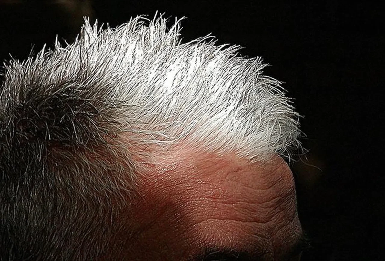 Saçların erken beyazlamasını önlemek düşündüğünüzden daha basit! 4 adımda beyaz saçlara veda edin