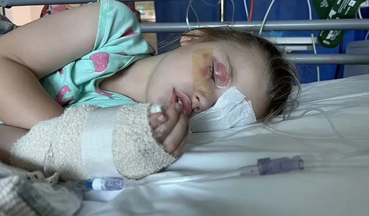 Çocuk şeker zannedip ısırdı, bir gözü kör oldu! Anne şimdi herkesi uyarıyor