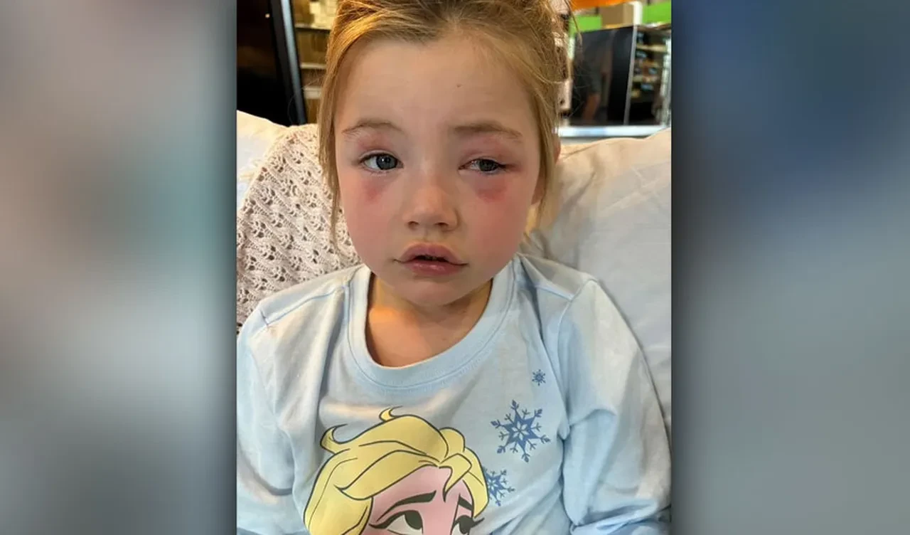 Çocuk şeker zannedip ısırdı, bir gözü kör oldu! Anne şimdi herkesi uyarıyor