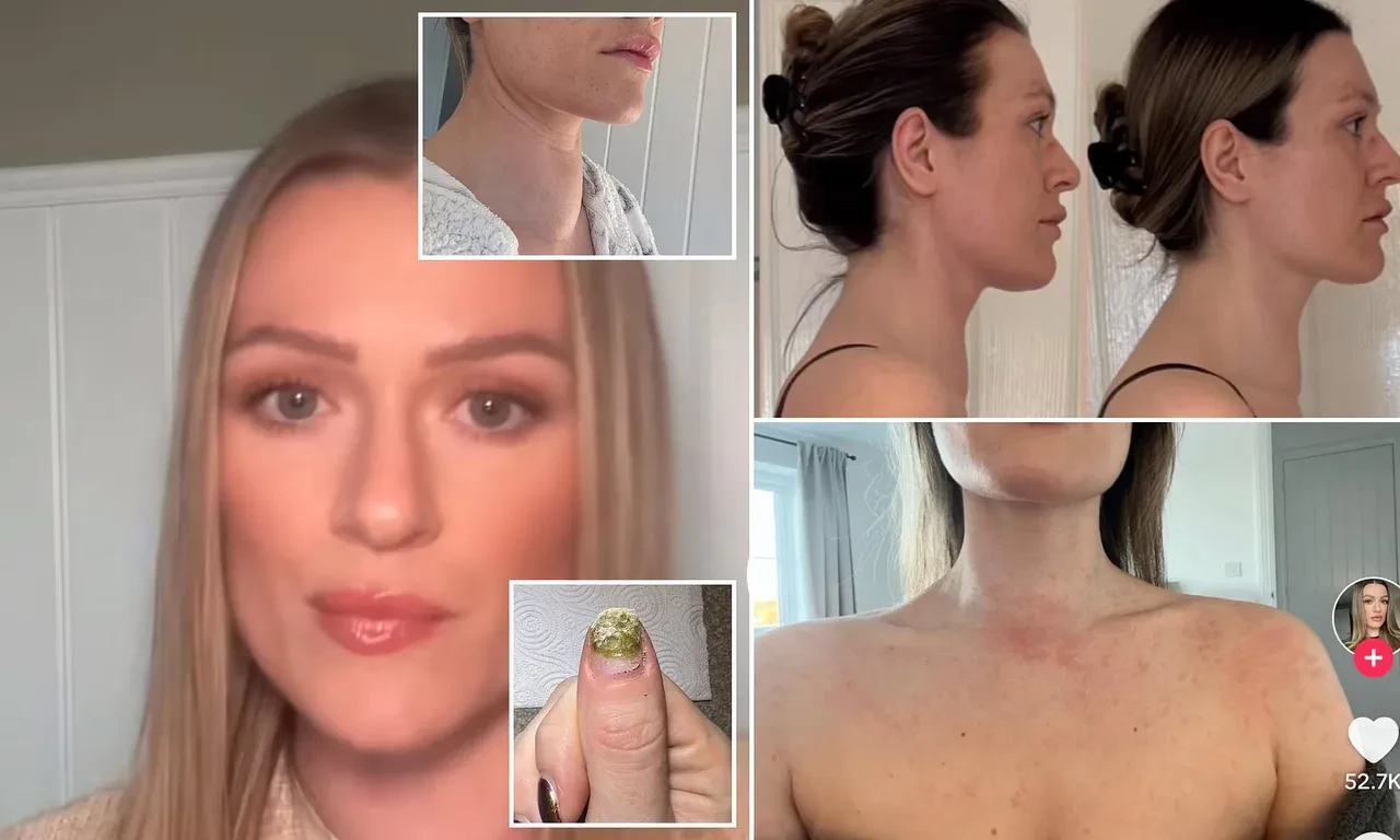 Yıllarca önemsemediği bu belirtilerin ardından kanser çıktı! 27 yaşındaki kadının pişmanlığı