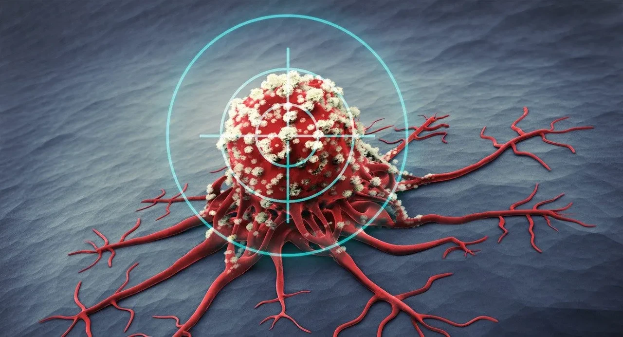 Yıllarca önemsemediği bu belirtilerin ardından kanser çıktı! 27 yaşındaki kadının pişmanlığı