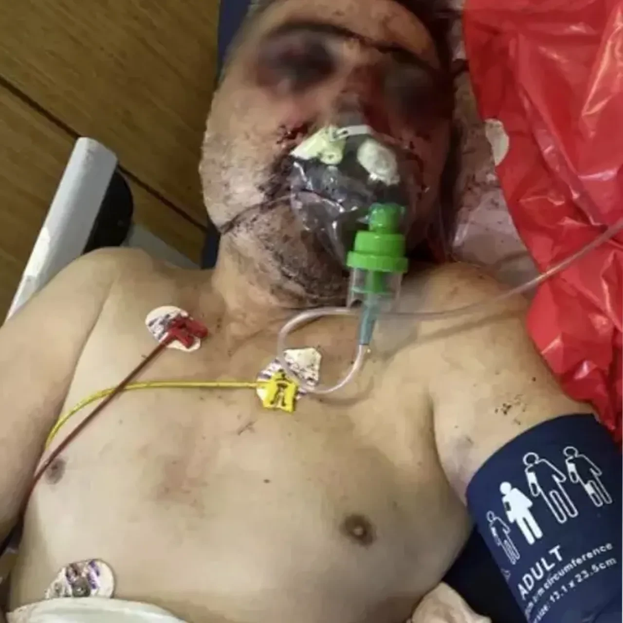 İngiliz turist tarafından öldüresiye darp edilmişti! İşte taksicinin yaşadığı dehşetin görüntüleri