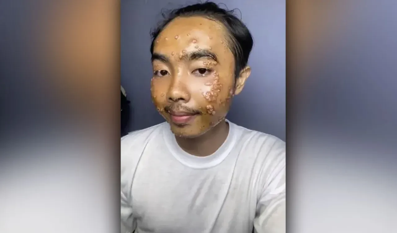 İkinci el mağazasından aldığı giysi yüzünü mahvetti! Uzmanlardan kritik uyarı geldi