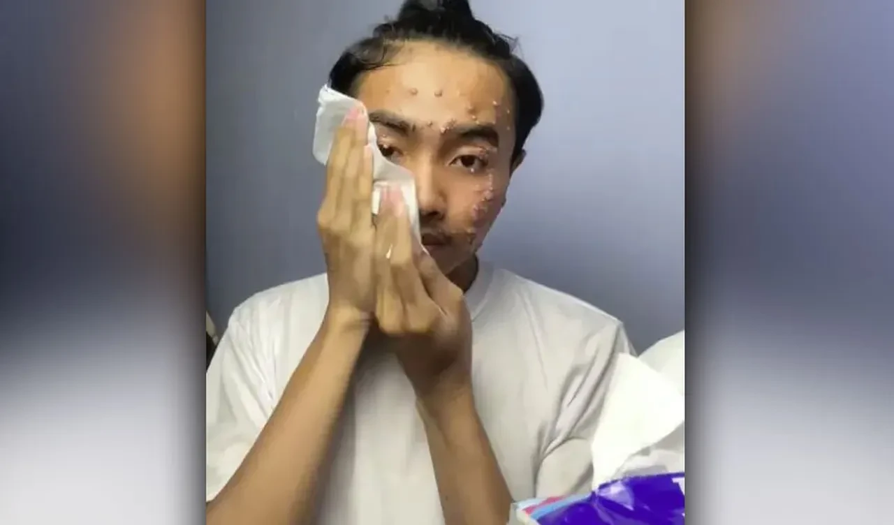 İkinci el mağazasından aldığı giysi yüzünü mahvetti! Uzmanlardan kritik uyarı geldi