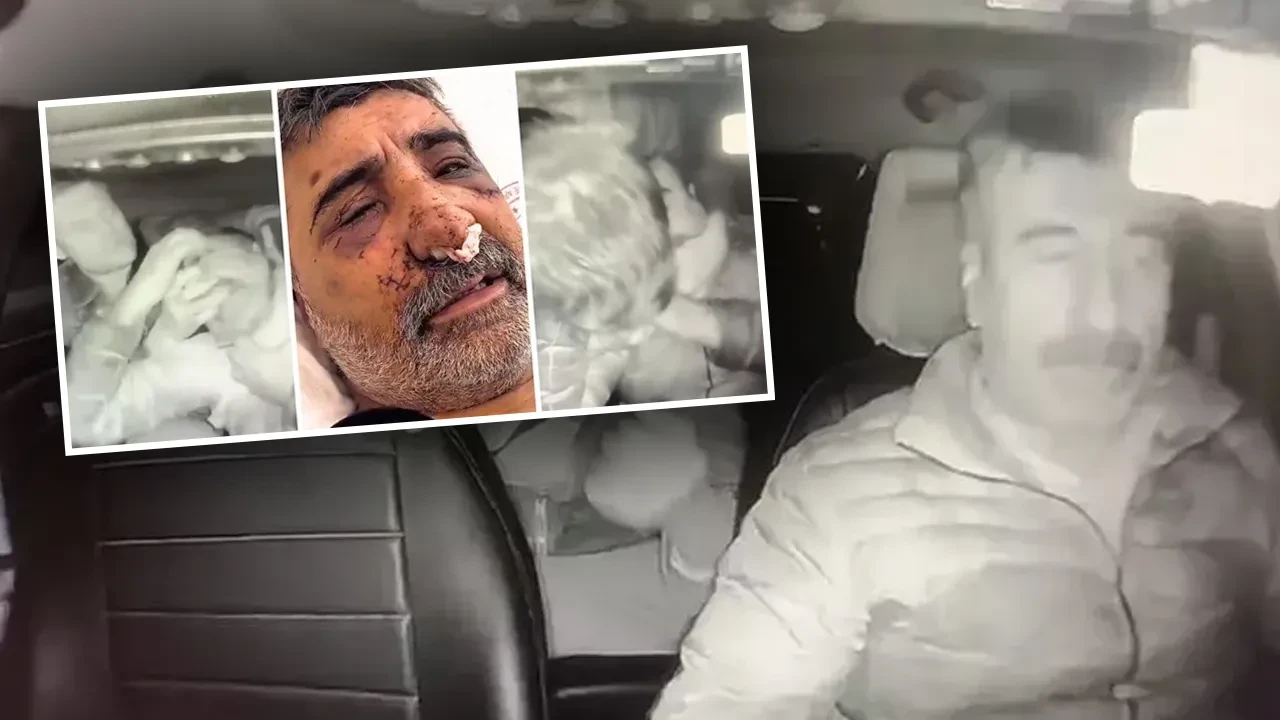 İngiliz turistin öldüresiye dövdüğü taksici dehşet anlarını anlattı! 'Isırdı, tırmaladı, parçaladı'