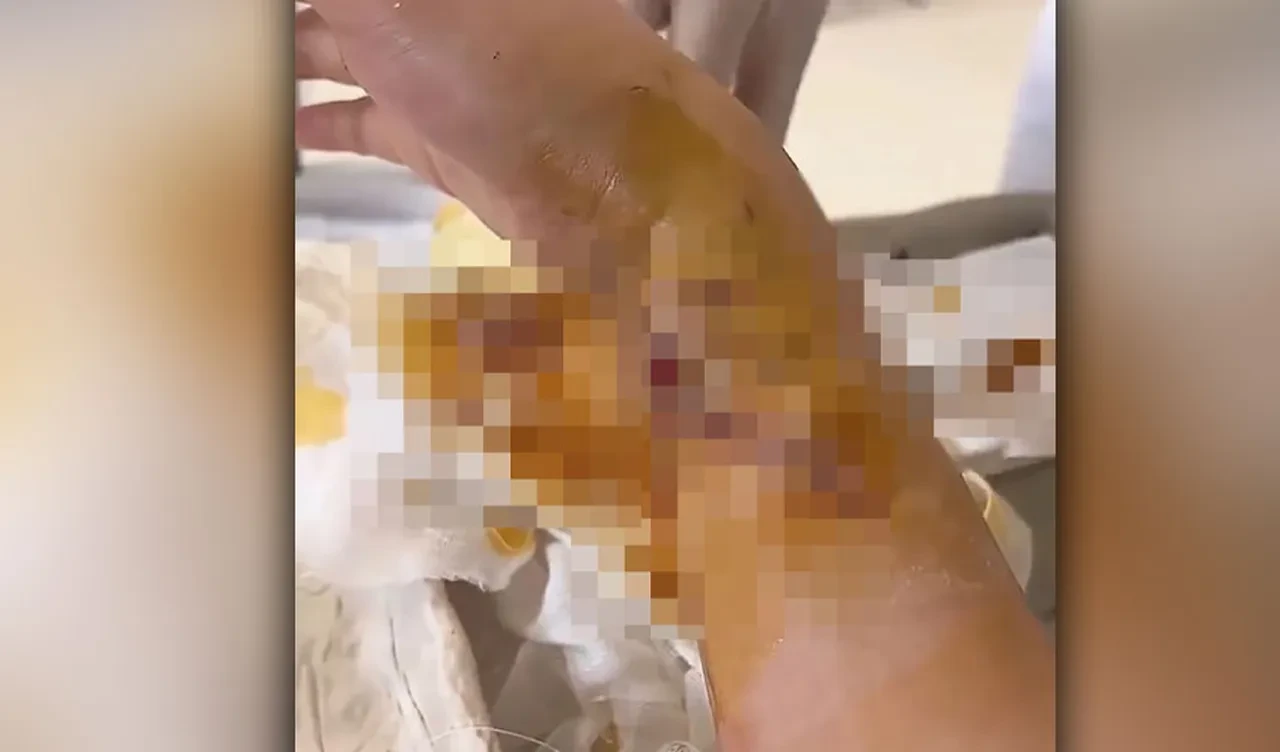 'Deniz kızı'na köpek balığı saldırısı! Havuz kan gölüne, gösteri dehşete dönüştü