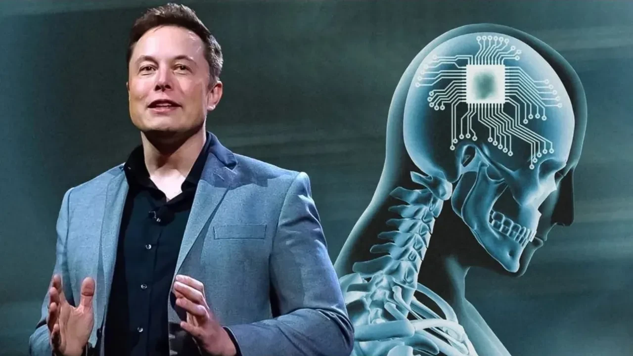 Elon Musk Türklere beyin çipi takacak! Detaylar belli oldu