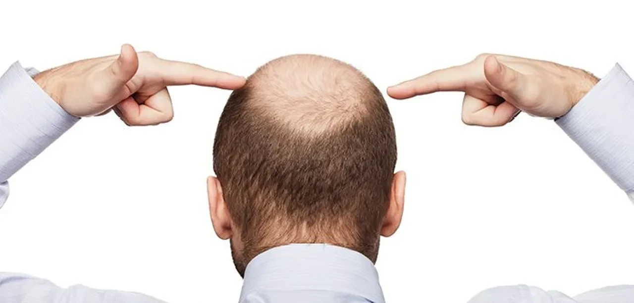 Saç ektirme ve boyatma İslam'da caiz mi?