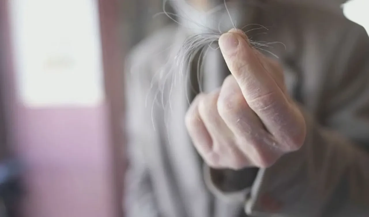 Kabak pişirip yedi başına gelmeyen kalmadı! Zehirli olduğunu öğrenince şoke oldu